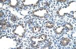 Ankyrin 1 Antibody in Immunohistochemistry (IHC)