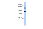 UGT1A9 Antibody in Western Blot (WB)