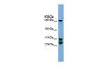 DNAI2 Antibody in Western Blot (WB)