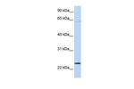 CHAC1 Antibody in Western Blot (WB)