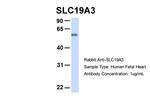 SLC19A3 Antibody in Western Blot (WB)