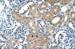 PPAP2A Antibody in Immunohistochemistry (IHC)