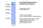 Pannexin 2 Antibody in Western Blot (WB)