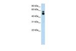 HDAC9 Antibody in Western Blot (WB)