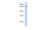 RNF139 Antibody in Western Blot (WB)