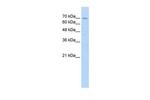 FBXL5 Antibody in Western Blot (WB)