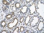 UBE2J1 Antibody in Immunohistochemistry (Paraffin) (IHC (P))