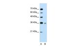 UBE2J1 Antibody in Western Blot (WB)