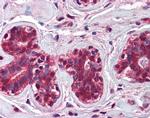 CHFR Antibody in Immunohistochemistry (IHC)