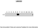 UBE2E2 Antibody in Western Blot (WB)