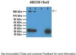 ABCC9 Antibody in Western Blot (WB)