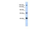 ABCC9 Antibody in Western Blot (WB)