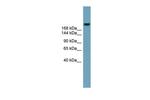 ABCA12 Antibody in Western Blot (WB)