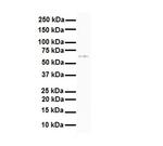 SLC7A1 Antibody in Western Blot (WB)