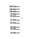 SLC27A2 Antibody in Western Blot (WB)