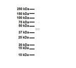 SLC27A2 Antibody in Western Blot (WB)