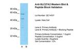 SLC27A2 Antibody in Western Blot (WB)