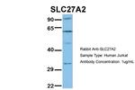 SLC27A2 Antibody in Western Blot (WB)