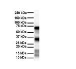 SLC25A12 Antibody in Western Blot (WB)