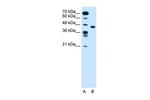 SLC35C1 Antibody in Western Blot (WB)