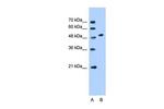 SLC30A1 Antibody in Western Blot (WB)