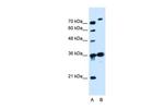 SLC9A7 Antibody in Western Blot (WB)