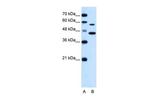 SLC39A5 Antibody in Western Blot (WB)