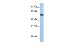 SLC39A5 Antibody in Western Blot (WB)