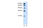 SLC36A3 Antibody in Western Blot (WB)