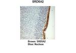 SRD5A2 Antibody in Immunohistochemistry (IHC)