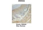 SRD5A2 Antibody in Immunohistochemistry (IHC)