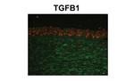 TGFBI Antibody in Immunohistochemistry (IHC)