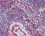 MCTP1 Antibody in Immunohistochemistry (Paraffin) (IHC (P))