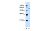 ALG11 Antibody in Western Blot (WB)