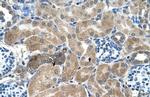 Syntenin 1 Antibody in Immunohistochemistry (IHC)