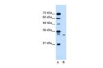 Syntenin 1 Antibody in Western Blot (WB)