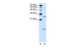 VMA21 Antibody in Western Blot (WB)