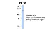 PLD3 Antibody in Western Blot (WB)