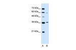 PARL Antibody in Western Blot (WB)