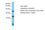 SLC38A10 Antibody in Western Blot (WB)