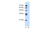 CLCC1 Antibody in Western Blot (WB)