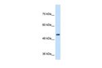 SPPL2B Antibody in Western Blot (WB)