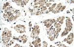 FKTN Antibody in Immunohistochemistry (IHC)