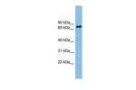 Lamin B Receptor Antibody in Western Blot (WB)