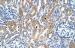 RAP Antibody in Immunohistochemistry (IHC)