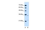 RAP Antibody in Western Blot (WB)