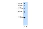 Tapasin Antibody in Western Blot (WB)