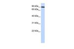 TFR2 Antibody in Western Blot (WB)