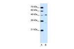 CHST1 Antibody in Western Blot (WB)