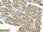 HAL Antibody in Immunohistochemistry (IHC)